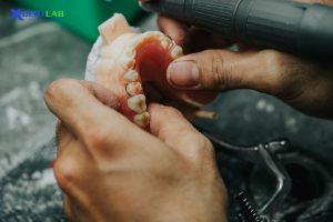 full-removable-denture